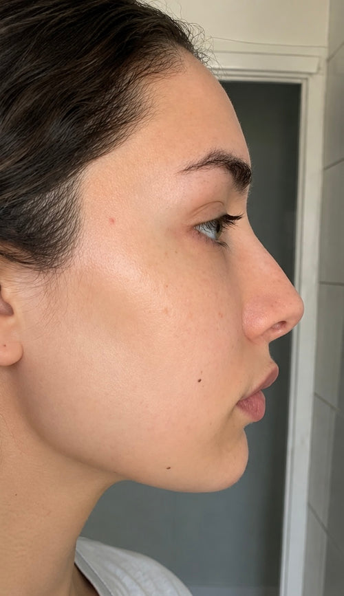 After 1 Month